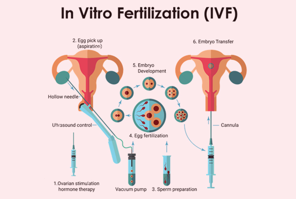 Fertility & IVF